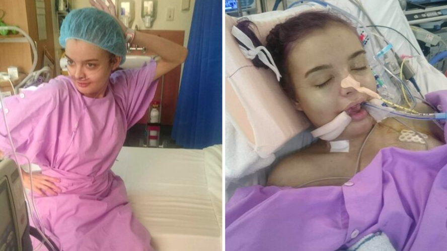 Two photos of Abi in hospital with a tube in her nose.