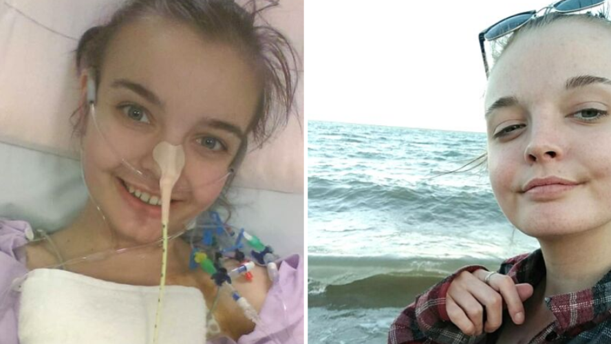 Two photos of Abi. In one, she is in hospital lying in bed with lots of tubes around her. In the second she is at the beach feeling well.